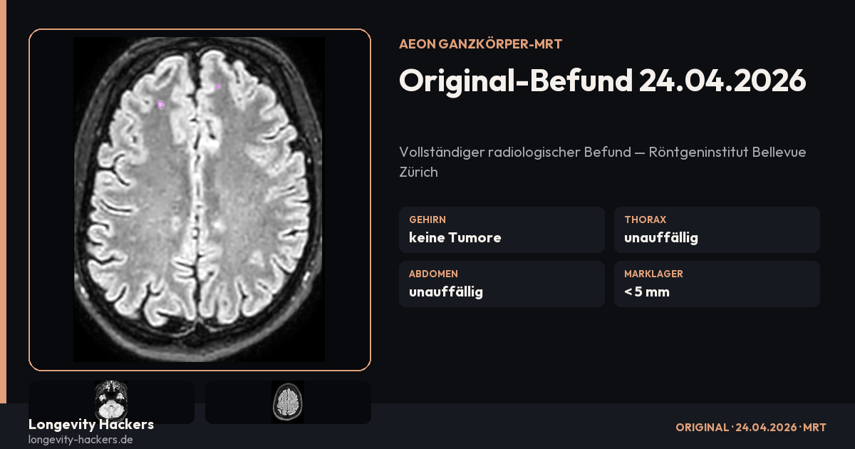 Mein Aeon Ganzkörper-MRT-Befund — Benedikt Keck (24.04.2026)
